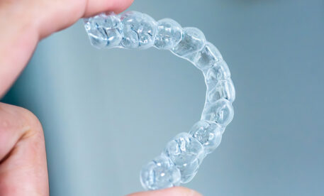 Invisalign vs Spark Aligners: A Manchester Patient’s Guide