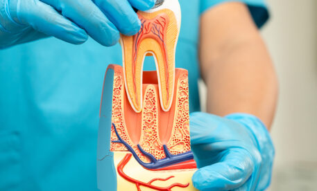 Signs You Might Need Root Canal Treatment