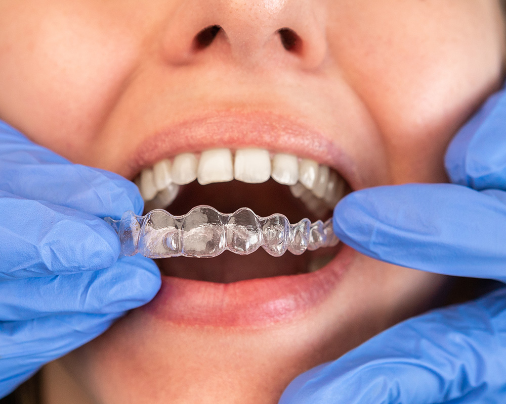 SparkAligner_Parkfield