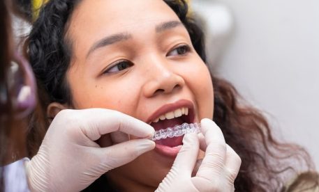 Achieve a Straighter Smile with Spark Aligners in Manchester