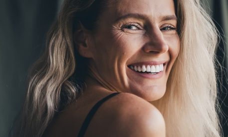 Common Dental Concerns Veneers Can Address