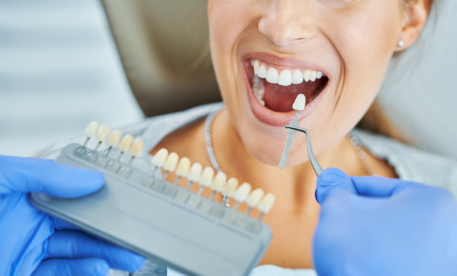 Teeth Whitening in Didsbury — Safe, Lasting Results | Parkfield Dental