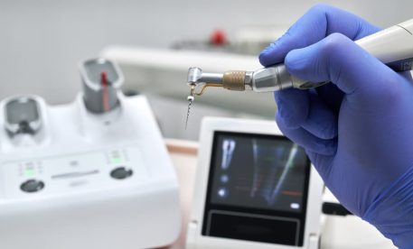 Signs You Might Need Root Canal Treatment