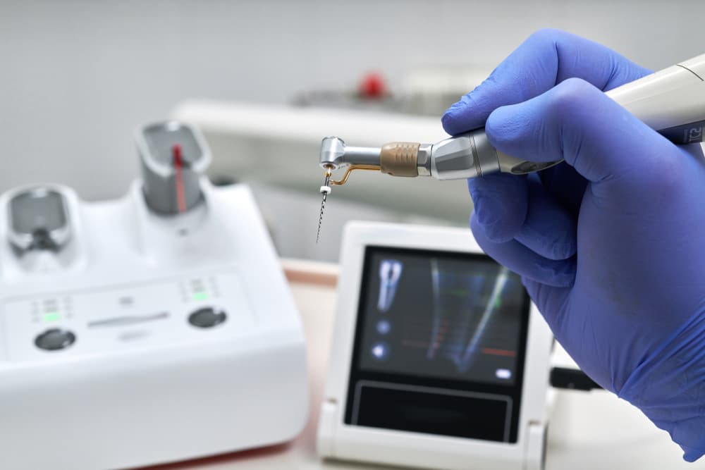 root canal treatment